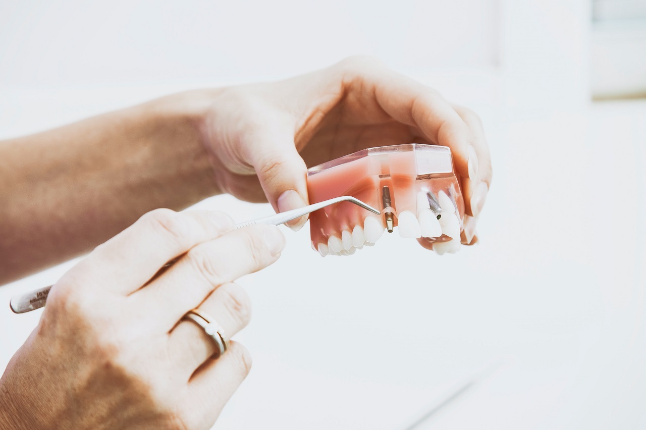 Jakie formy leczenia, mogą zaproponować dzisiejsi stomatolodzy?